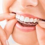 Clear Aligner in Kathmandu