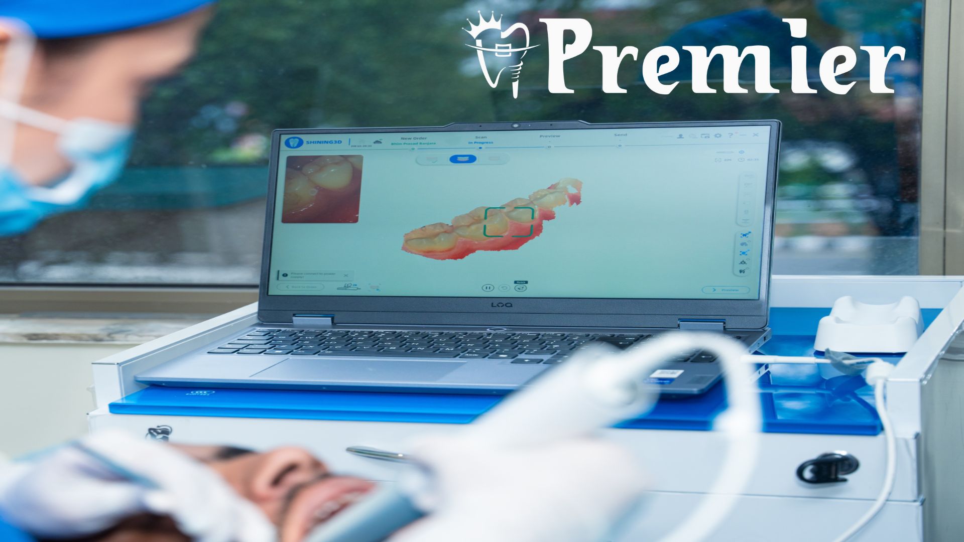 Clear Aligner Treatment Process at Premier Dental Kathmandu