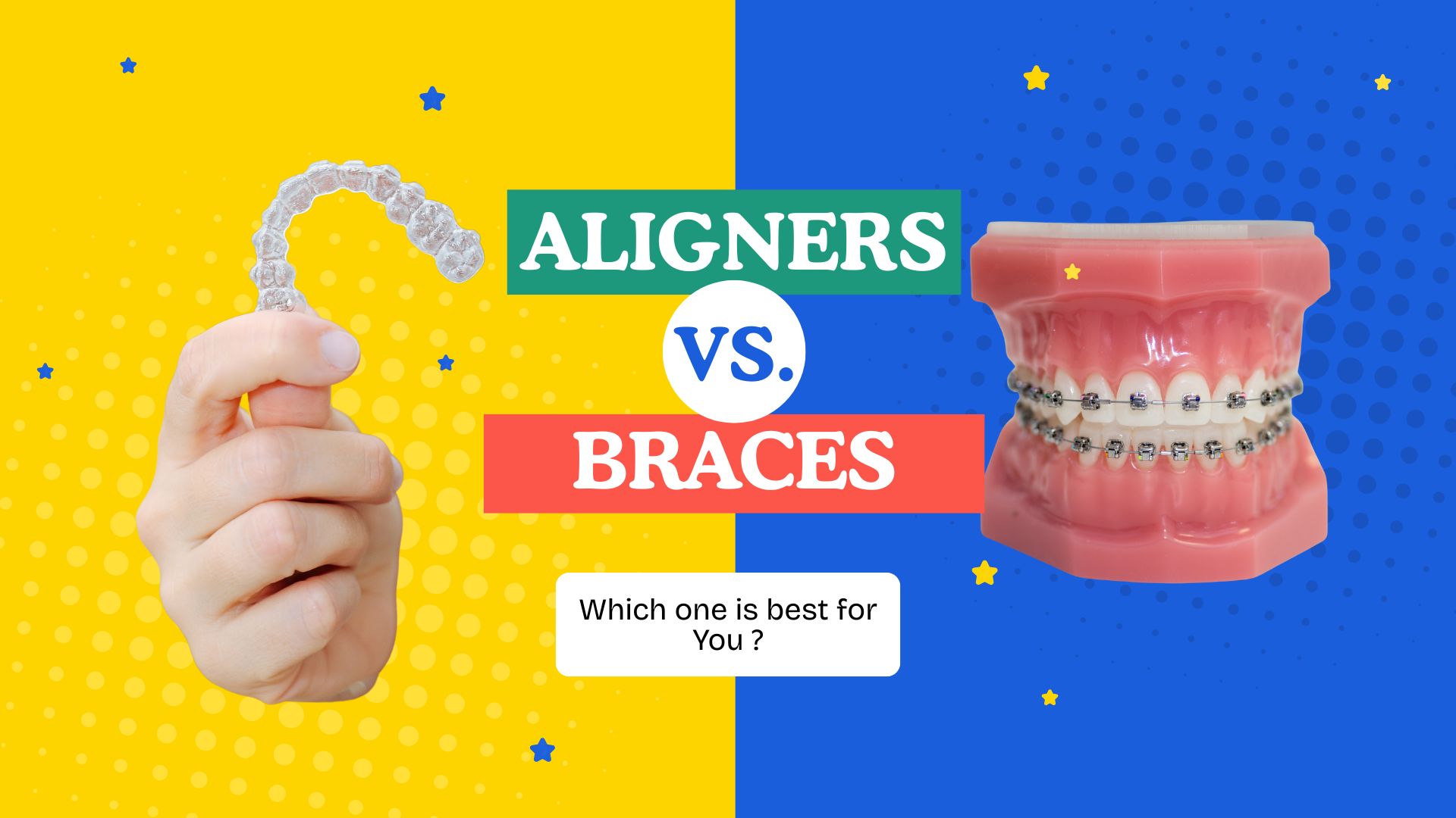 Clear Aligners vs Traditional Braces - Price and Benefits Comparison in Kathmandu