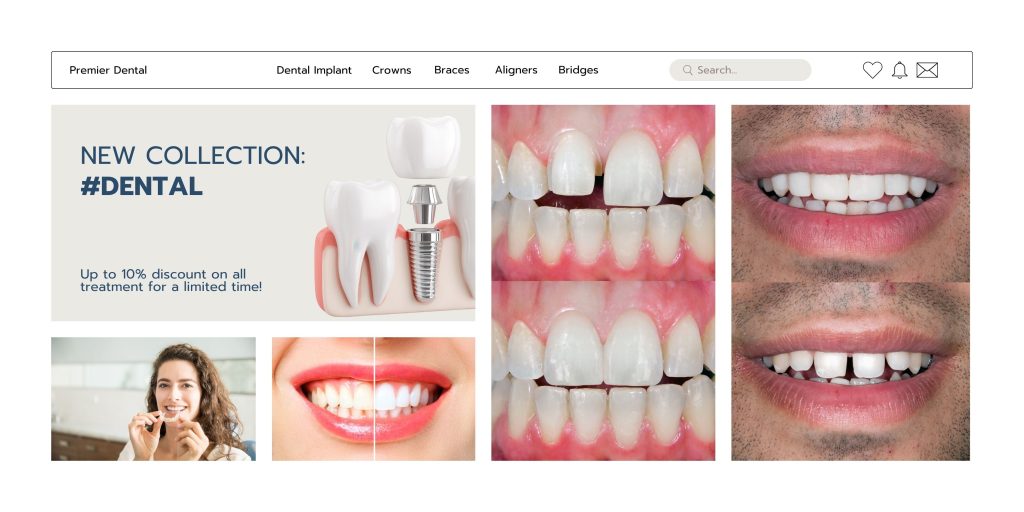 All treatment are available for dental care in Best Dental Clinic in Kathmandu Nepal