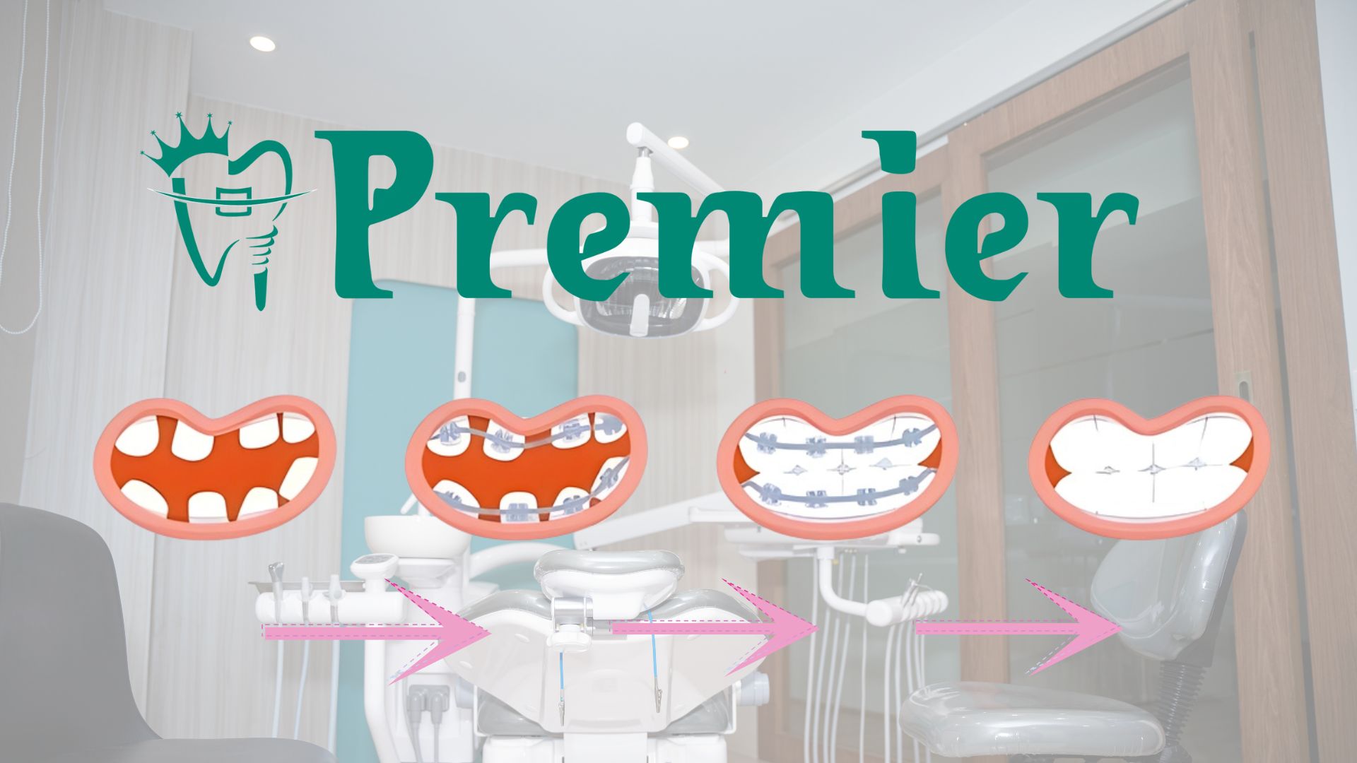 Price of braces in Kathmandu, Nepal - Timeline infographic showing the complete braces journey from consultation to final smile