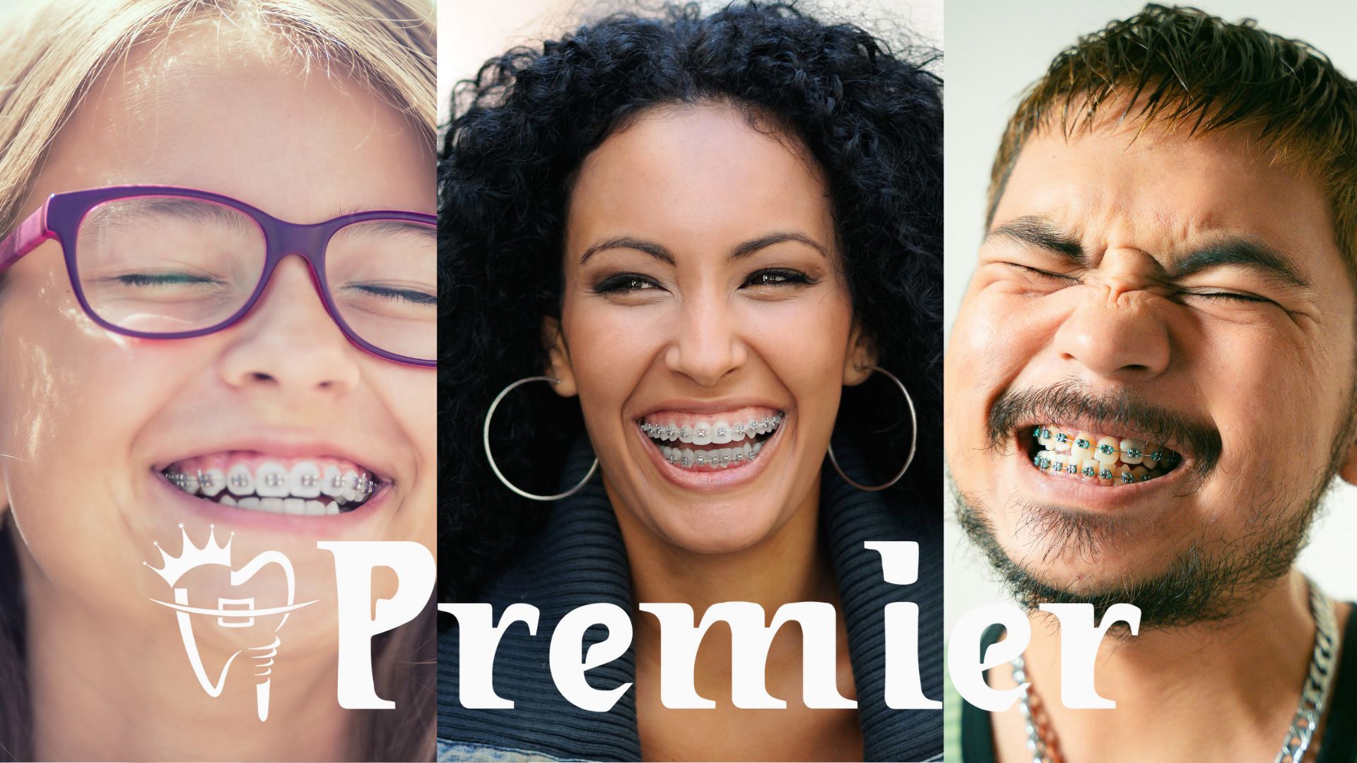 Price of braces in Kathmandu, Nepal - Collage showing patients of different ages (child, teenager, adult) wearing braces