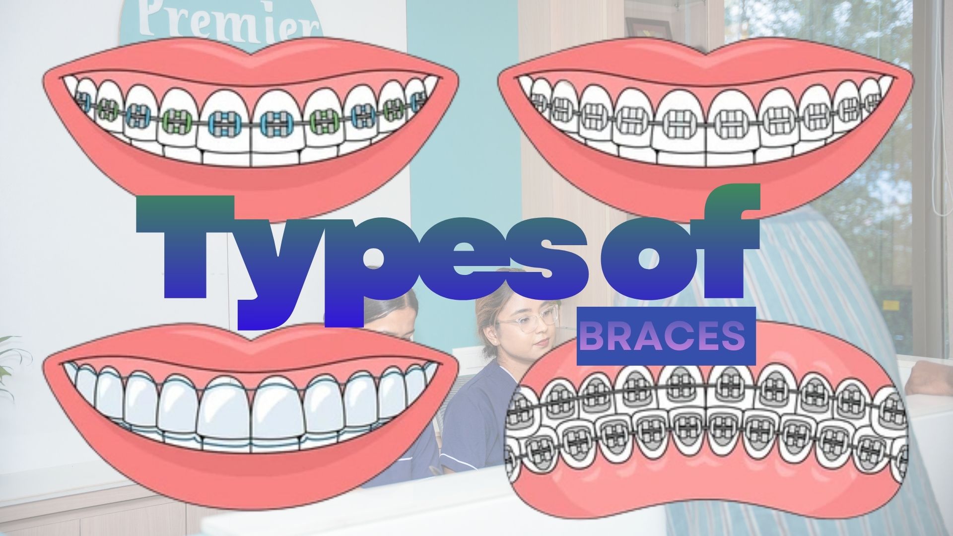 Price of braces in Kathmandu, Nepal - Comparison of different types of braces - metal, ceramic, and clear aligners