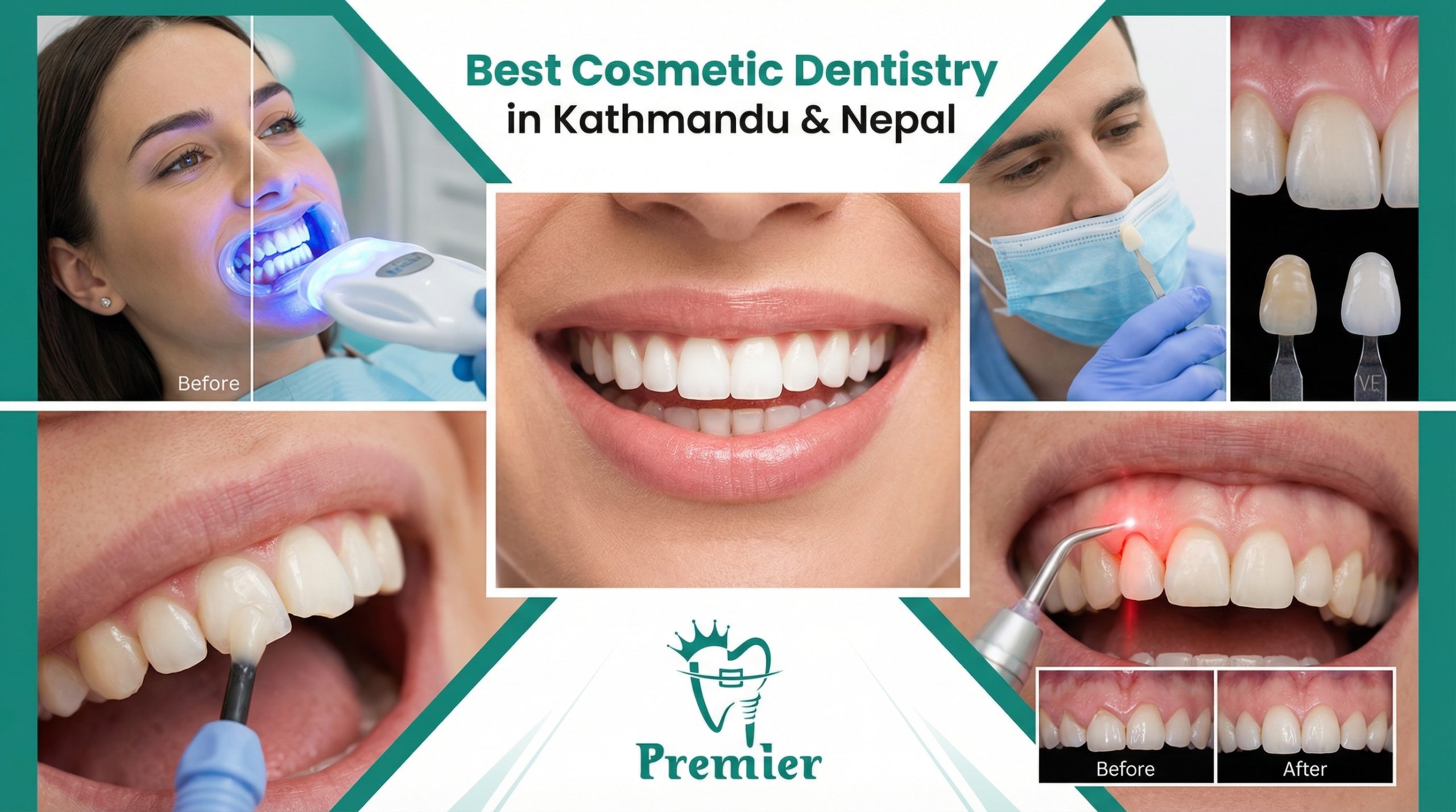 Best Cosmetic Dentistry in Kathmandu Nepal - Premier Dental