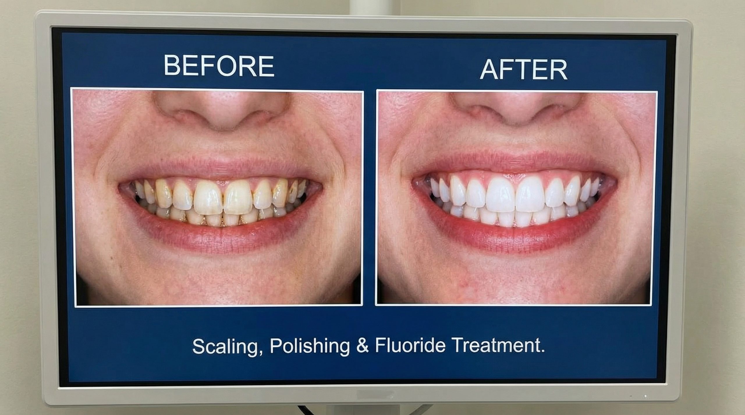 Before After Dental Treatment