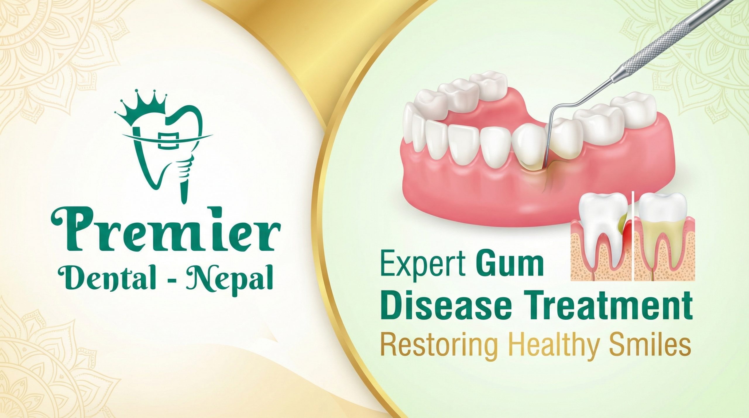 Best Gum Treatment in Kathmandu Nepal